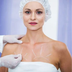 Breast lift treatment illustration